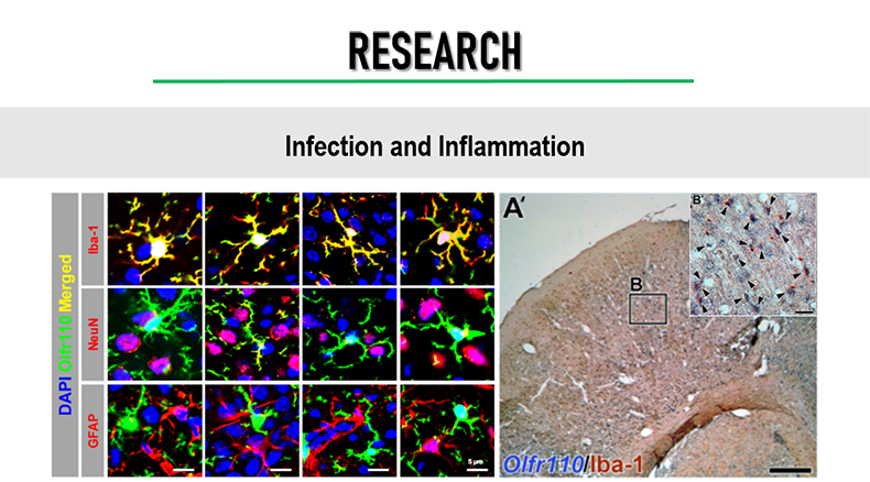 Infection and inflammation