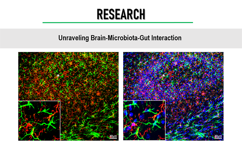 Unraveling brain-micobiota-gut interactions